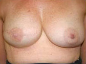 after image