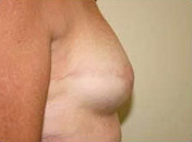 after image