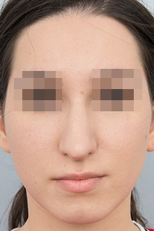 after image