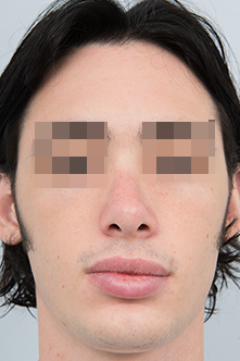 after image