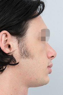 after image