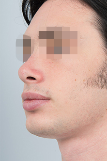 after image