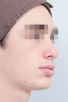 before image