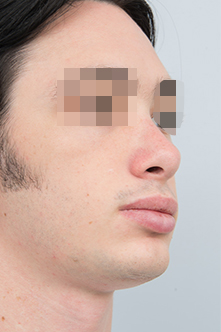after image
