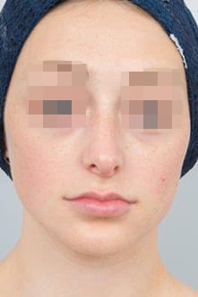after image